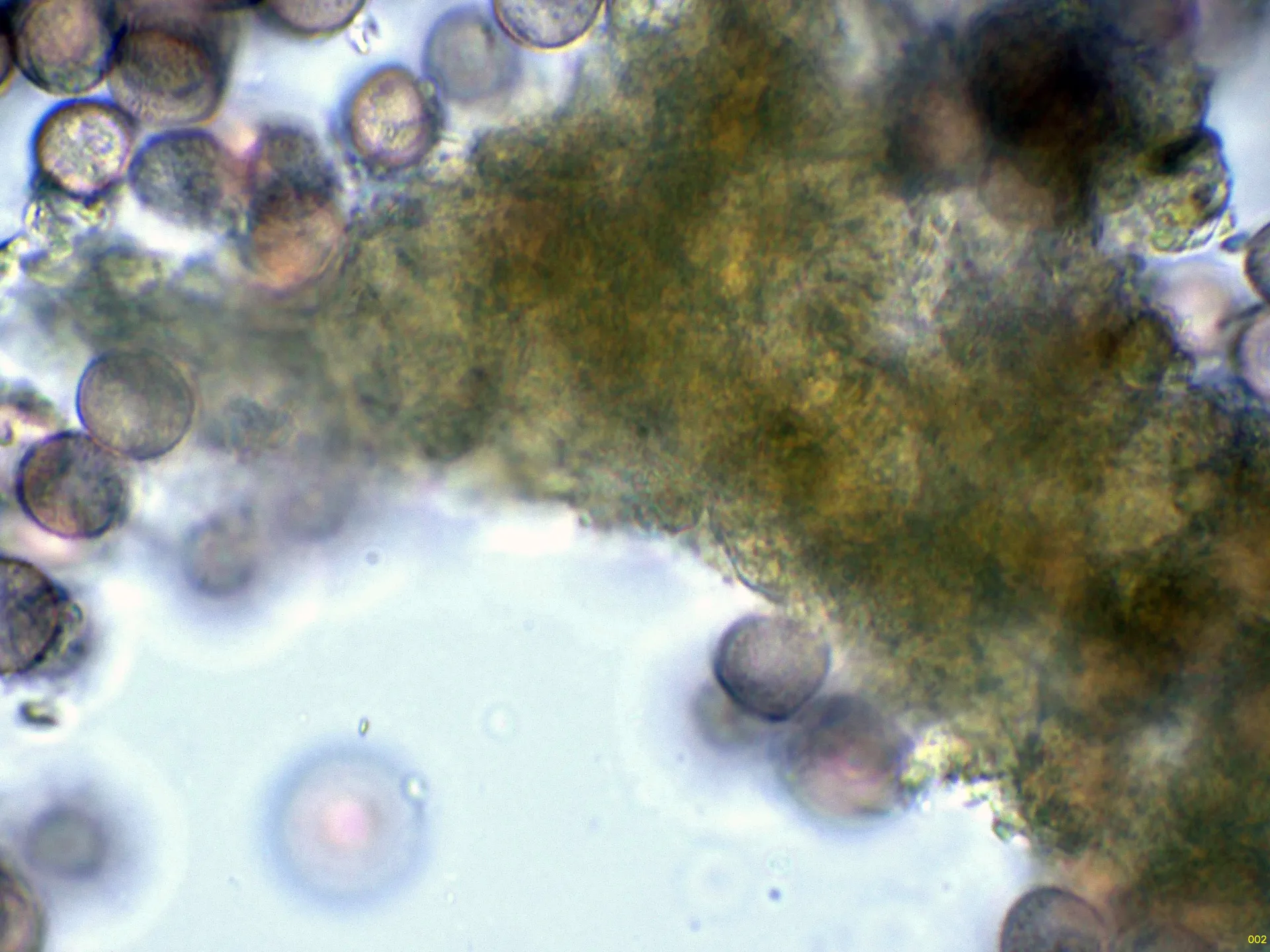 Microscopía de Physarum leucophaeum - 10 - Hifas pie agua-002